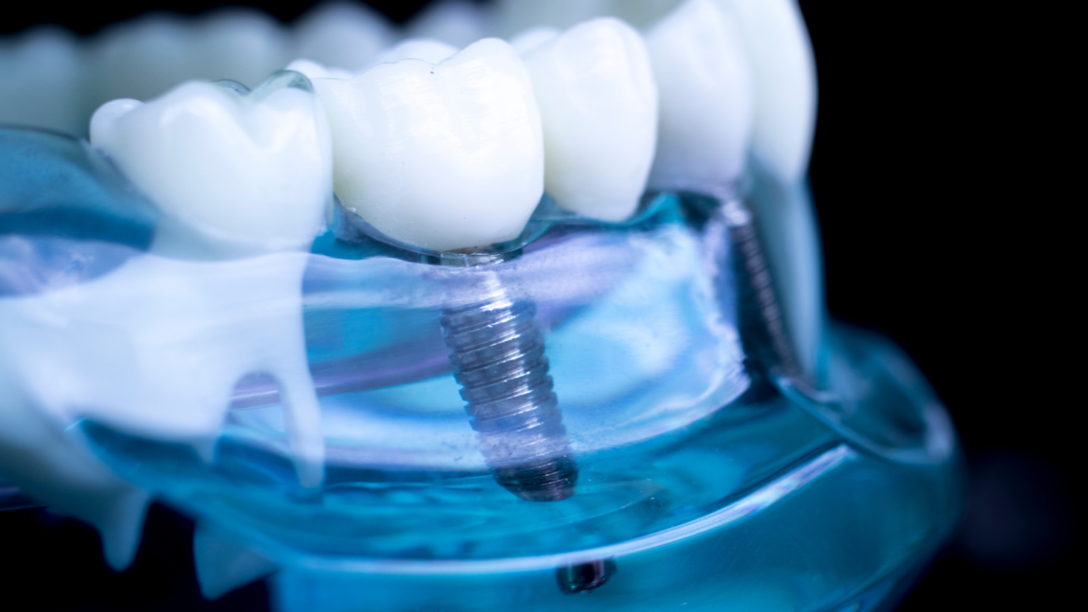dental implants office