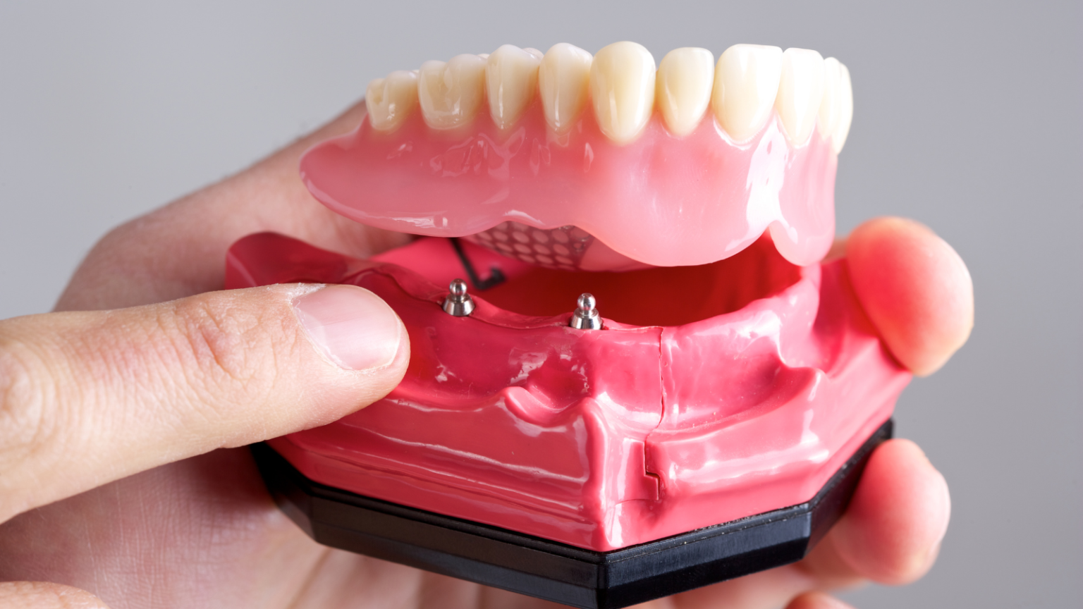 dentures near me