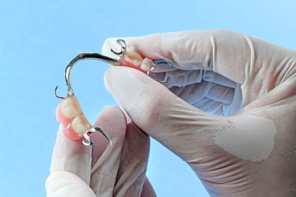 What Is A Dental Flipper – How Long You Can Wear It?