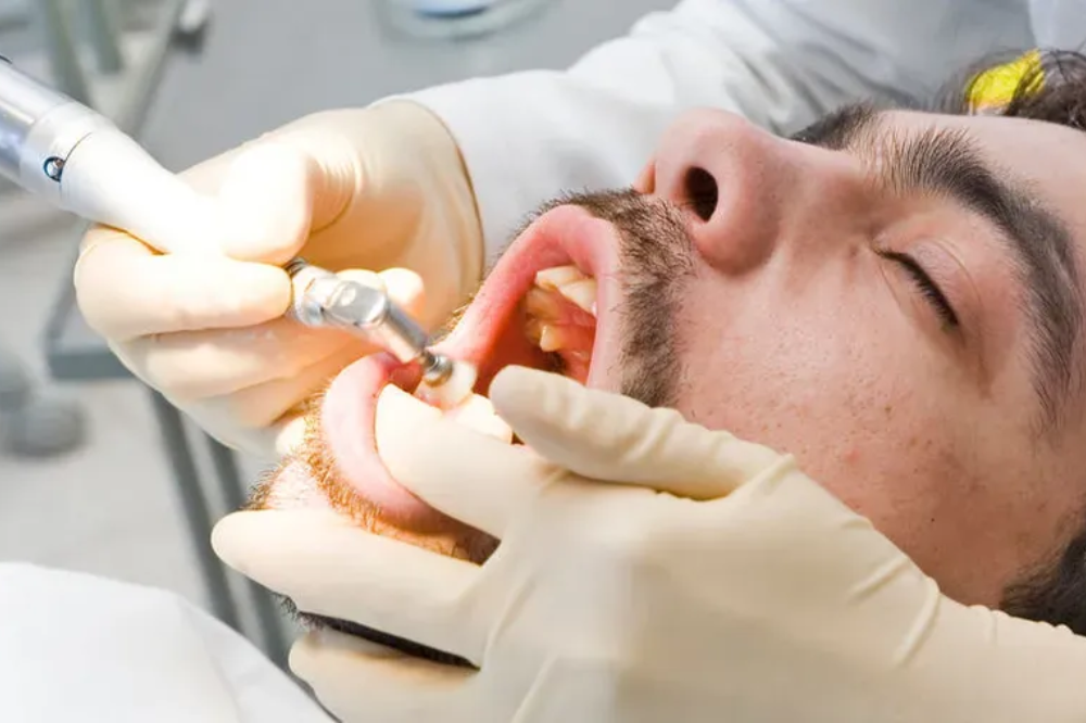 Can you fix a cavity in your front tooth