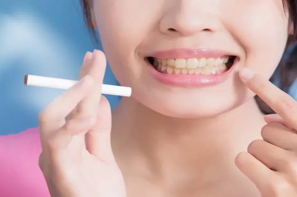 how to get rid of smoking stains on teeth