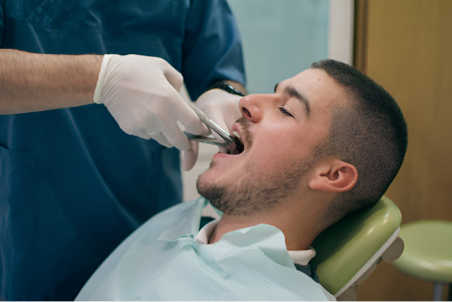 tooth extraction coral gables