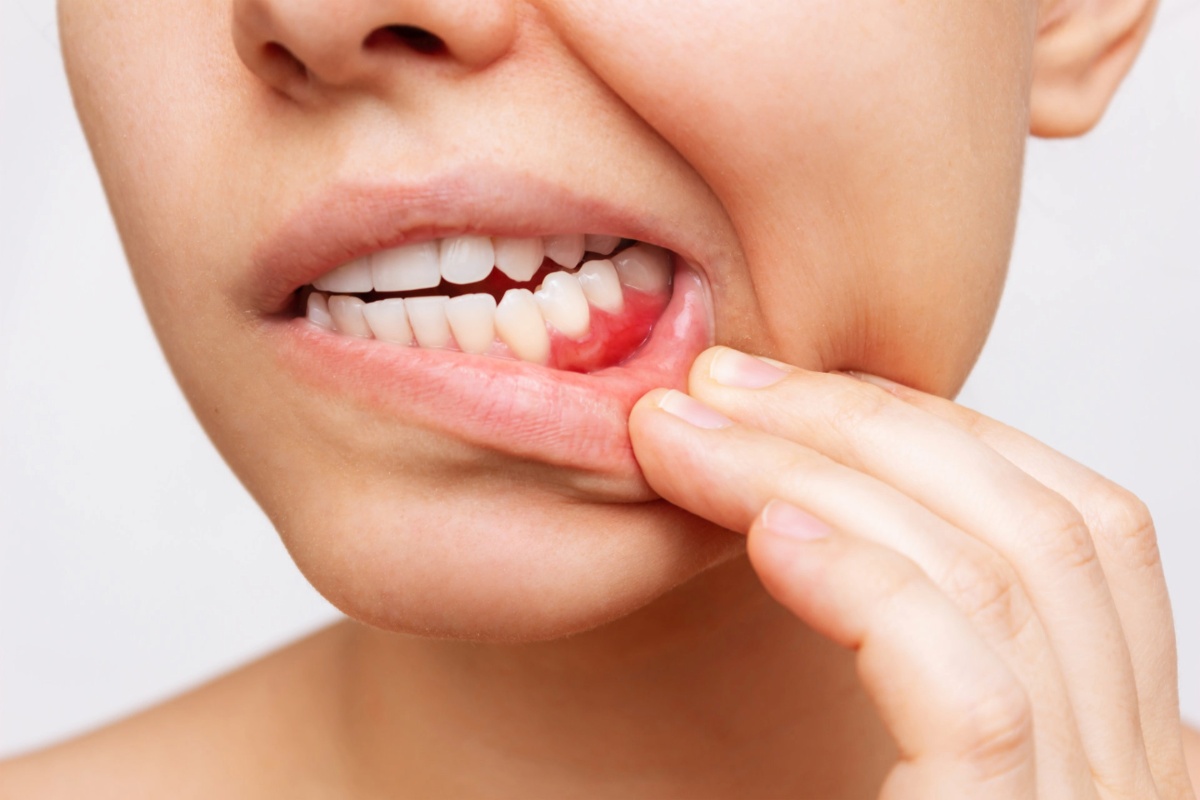 what is periodontal treatment