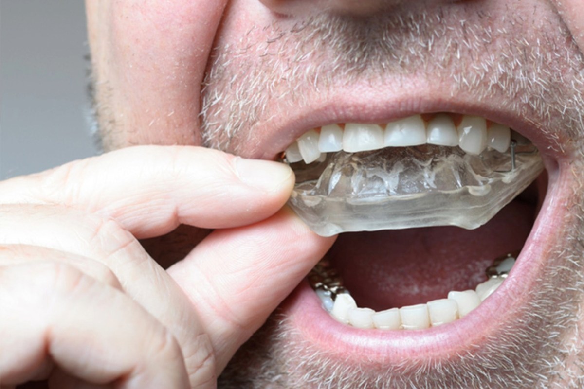 night guard for teeth grinding