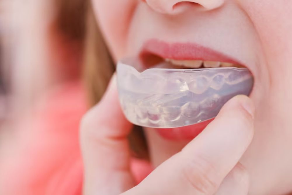 how-mouth-guards-help-prevent-dental-injuries
