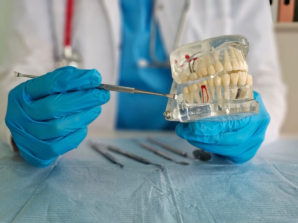 at what point is it too late for a root canal