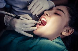dentist performing root canal treatment