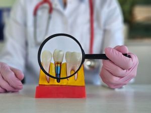 dental implant treatment model