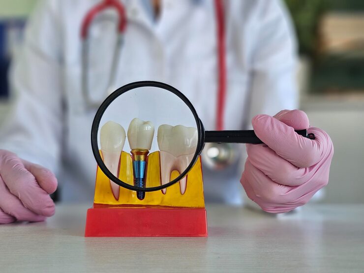 dental implant treatment model